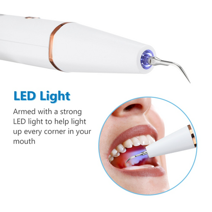 Sonic Smile™ - Ultrasonic Plaque Remover